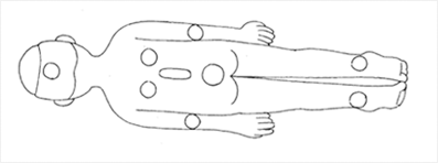 똑바로 누워 있을 경우 (뒤 부분에 욕창이 생김)
