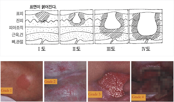 표면이 붉어진다.