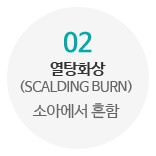 02_열탕화상: 소아에서 흔함