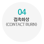 03_접촉화상 
