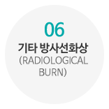 06_기타 방사선화상