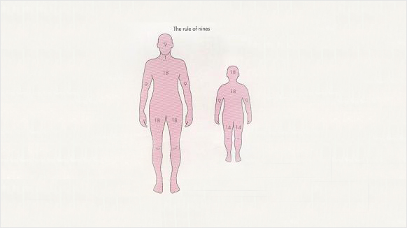 화상범위의 진단
